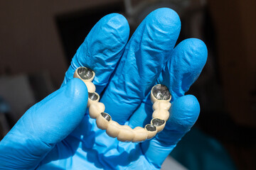 The dentist holds a ceramic, zirconium, bridge-shaped, non-removable dental prosthesis in his hand. Dental bridge.	