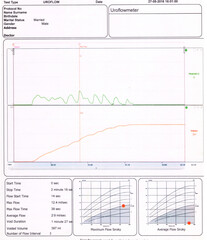 Uroflow medical test report of 60 years male