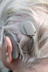 Elderly Person with Cochlear Implant: Hearing Technology at the Back of the Head