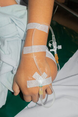 Hand inserted with saline needle