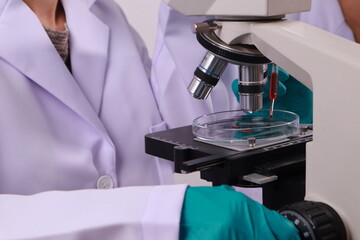 Researcher hand holding a blood vessel Vascular examination in a research laboratory Medical science laboratory, blood collection