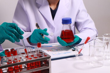 Researcher hand holding a blood vessel Vascular examination in a research laboratory Medical...