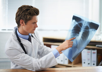 Man doctor in office, analysis of xray and health, medical diagnosis and review of lung scan at...