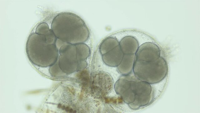 Hydrozoa Gonothyraea loveni under microscope, family Campanulariidae. The video shows the reproductive organs of Gonozooids, in which planulae are born.