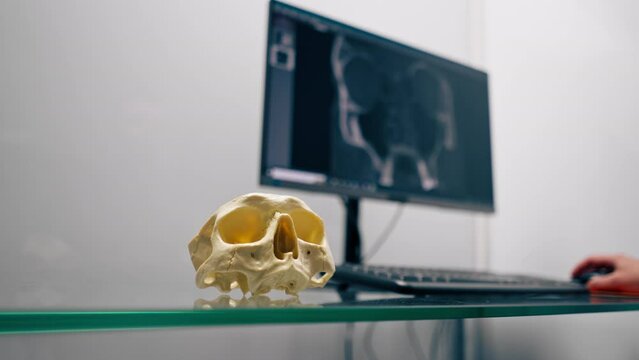 skull model on the background of a computer screen with a 3D image in a tomography or surgery room in a clinic