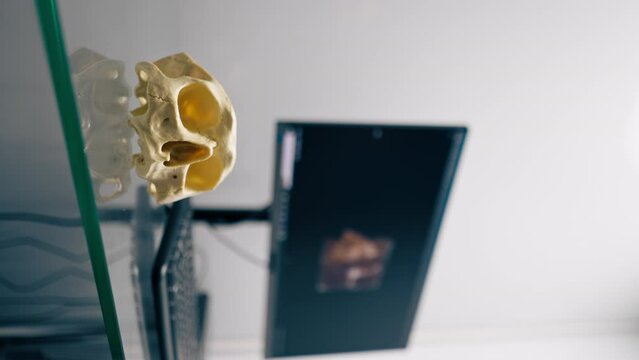 vertical video skull model on the background of a computer screen with a 3D image in a tomography or surgery room in a clinic