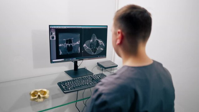 a radiologist doctor looks at a screen showing a 3D image of a nose scan to determine the results of plastic surgery in a clinic