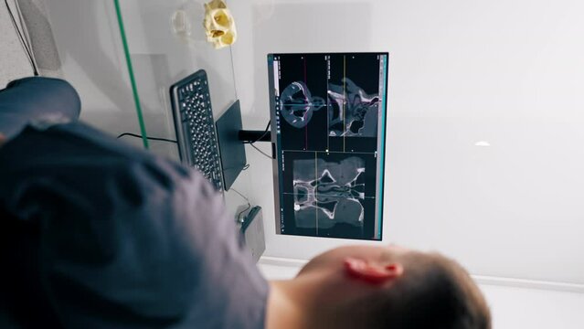 vertical video a radiologist doctor looks at a screen showing a 3D image of a nose scan to determine the results of plastic surgery in a clinic
