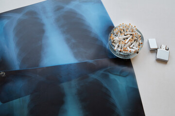 Overfilled ashtray with cigarette butts and lighter, close-up X-ray of lungs