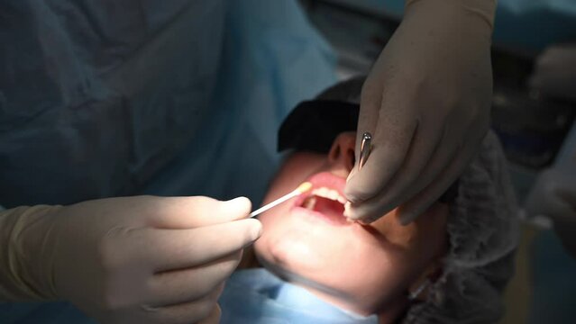 Beautiful Woman in dentist chair at appointment with dental surgeon during wisdom tooth removal and dental care process. 4k 120 fps slow motion cinematic footage