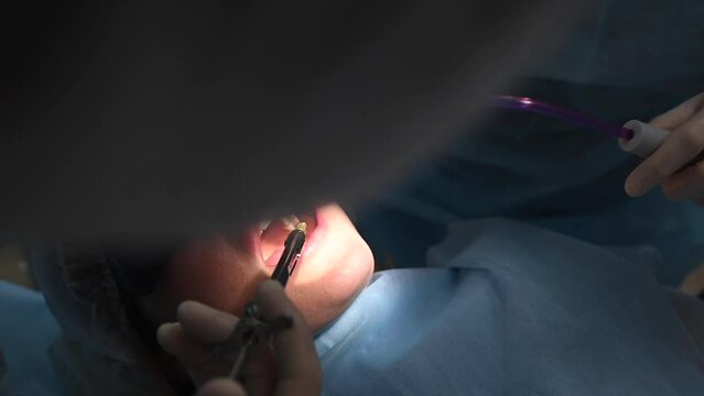 Beautiful Woman in dentist chair at appointment with dental surgeon during wisdom tooth removal and dental care process. 4k 120 fps slow motion cinematic footage