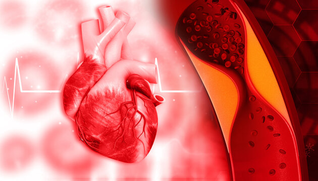 Human heart with Clogged arteries on scientific background. 3d illustration.