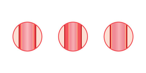 Arterial vasoconstriction and vasodilation. Cross section of arteries. Comparison of normal, constricted, and dilated blood vessels. Scientific Diagram. Vector illustration.