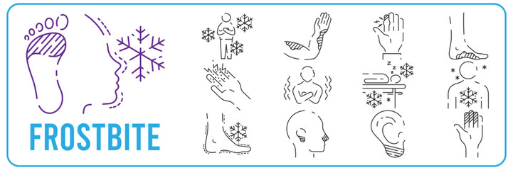 Frostbite. Symptoms, Line icons set. Vector signs for web graphics - obrazy, fototapety, plakaty