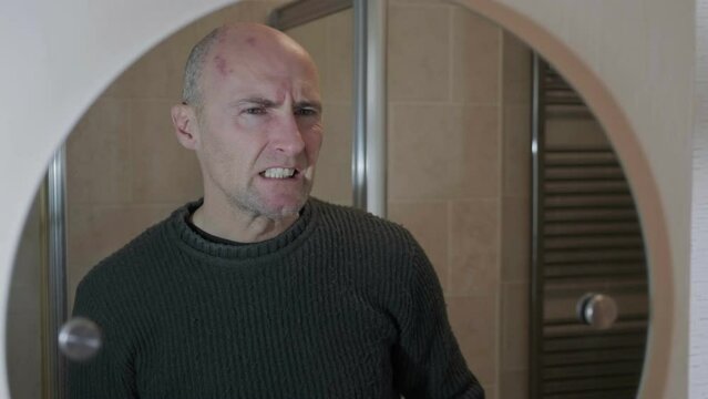 Man with painful shingles virus. Scabs and blisters on his face, head and above his eye. Reflection in bathroom mirror.