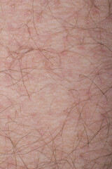 Human skin with hairs, human skin in macro