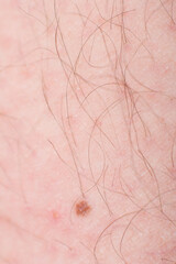 Human skin with hairs, human skin in macro