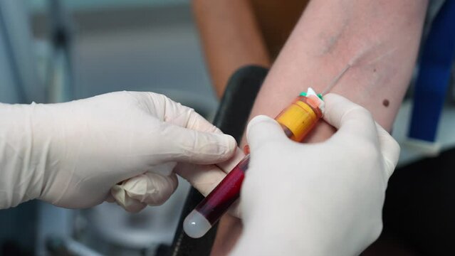 Laboratory assistant taking blood with vacuum capsule for test from the arm vein in the laboratory. Procedure of a blood capture from a vein for carrying out of laboratory analyses
