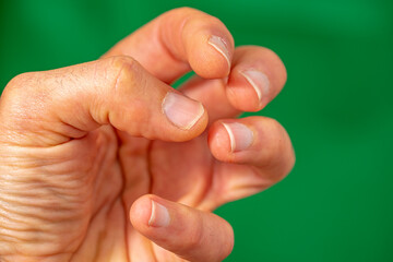 5 human fingers together of the hand with bitten nails under green background
