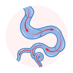 Obraz premium Varicose veins. Blue blood vessel visible through the skin. Vascular disease diagnostic and treatment. Venous insufficiency medical