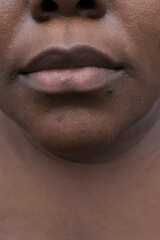 Obraz premium Brown skin with dark spots, hyperpigmentation on brown skin, african american woman with skin blemishes, imperfect skin