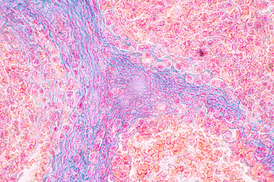 Structure of Tissue of Spleen Human, Liver Human and Kidney Human under the microscope in Lab.