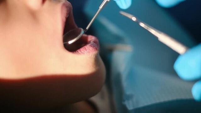 Compassionate female dentist assesses tooth decay in a young patient using a dental probe and angled mirror.