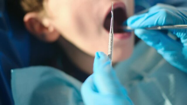 Caring female dentist using dental probe and angled mirror while doing tooth decay status on a young patient

