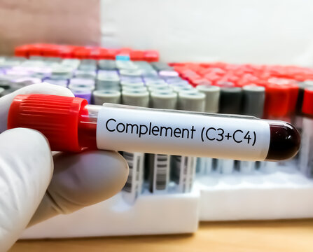 Blood sample for complement (C3+C4) test