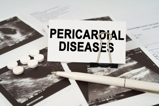 On the ultrasound pictures there is a pen and a business card with the inscription - pericardial diseases