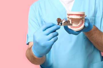 Male dentist with dental impression tray and jaw model on pink background, closeup. World Dentist Day