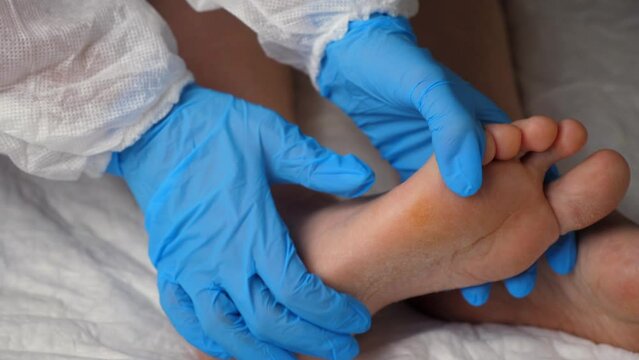 A nurse examines the patient's leg during the postoperative rehabilitation period, peeling of the skin.