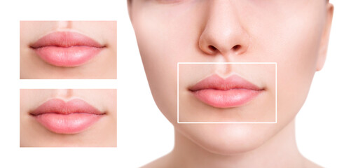 Young woman near set of different lips shapes.