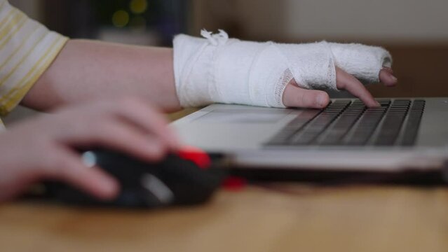 Unrecognizable child uses computer while wearing cast on his arm, closeup. Boy adapts to life during time of physical disability. Lifestyle of ordinary life with trauma.