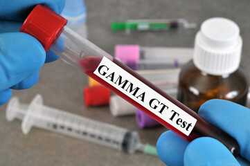 Tube d'analyse de sang pour le taux de Gamma GT