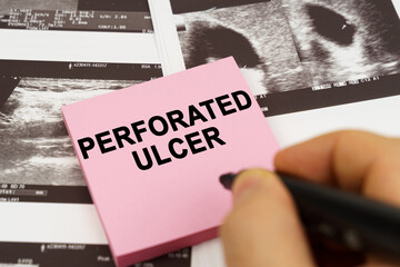 On the ultrasound pictures there are stickers that say - Perforated ulcer