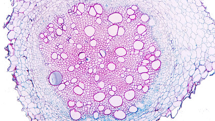Sunflower (Helianthus sp) old root cross section. Dicot root histology for education. Selective...