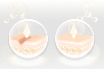 Hyaluronic acid before and after hair and skin solutions ad, white collagen serum drops into skin cells with cosmetic advertising background ready to use, illustration vector.