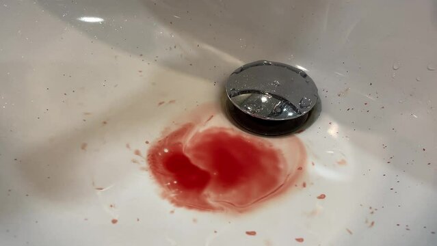 blood drain bathroom sink. health disorder