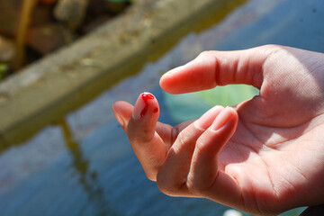 Photo of a finger cut, cut by a knife, bleeding fresh red blood