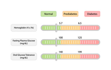 Blood sugar tests to measure blood glucose and diagnose diabetes. Fasting plasma glucose, hemoglobin A1C HbA1C and oral glucose tolerance tests. Vector illustration.