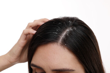 Fototapeta premium Woman examining her hair and scalp on white background, closeup. Dandruff problem
