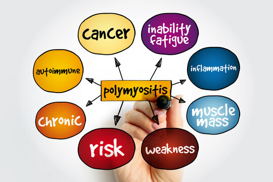 Polymyositis PM mind map, medical concept for presentations and reports