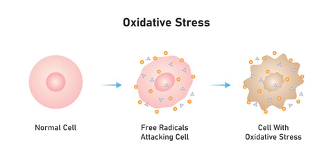 Oxidative Stress Process Scientific Design. Vector Illustration.	