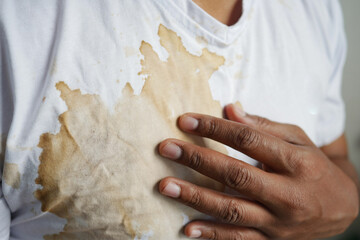  coffee spilled on white color shirt. drink stain on shirt