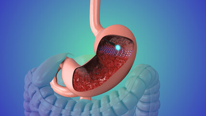 Upper gastrointestinal endoscopy medical animation - obrazy, fototapety, plakaty