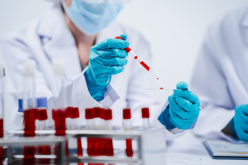 Professional scientists in lab working with blood samples. to find components in blood Ideas for...