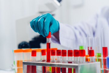 A scientist examines samples with a microscope in a laboratory with test tubes filled with colorful...