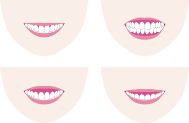 笑顔で歯ぐきが出るガミースマイルなど笑顔と歯列の見え方のベクターイラスト