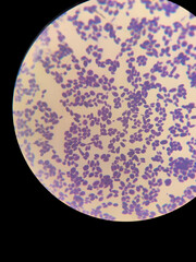 A smear of yeasts Wickerhamomyces anomalus under a microscope is stained with gentian violet or Gram